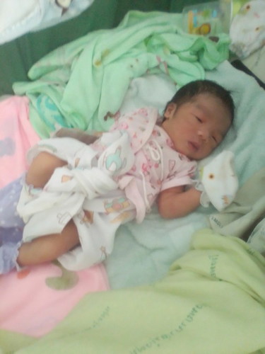 คลอดก่อกำหนด