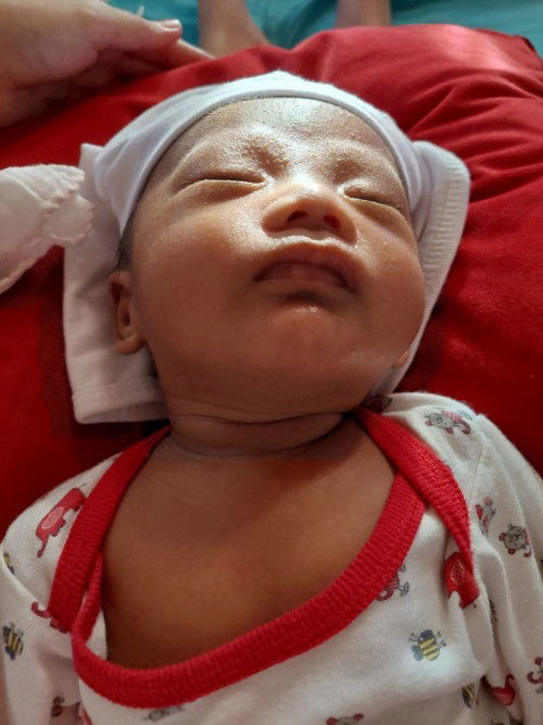 Spilled milk sa leeg