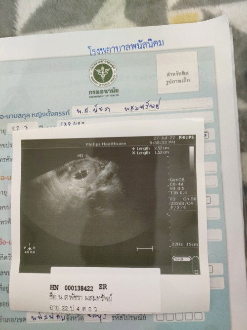 มีเลือดออกมา2วันไปหาหมอ หมออัลตร้าซาวด์+ตรวจภายใน ปากมดลูกปิดสนิท ถุงการตั้งครรภ์ยังอยู่ แต่ไม่เจอตั