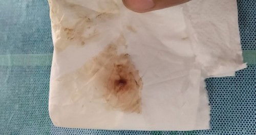 8 days po n late at  yn ung dugo n lumabas sakin ngaun morning pero kunti lng...at nag PT negative