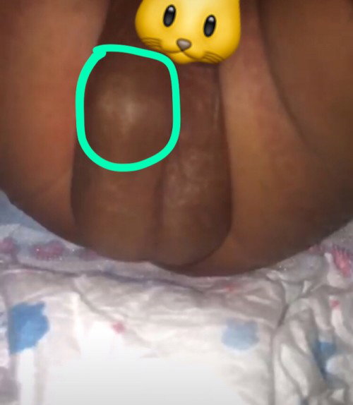 testis bati