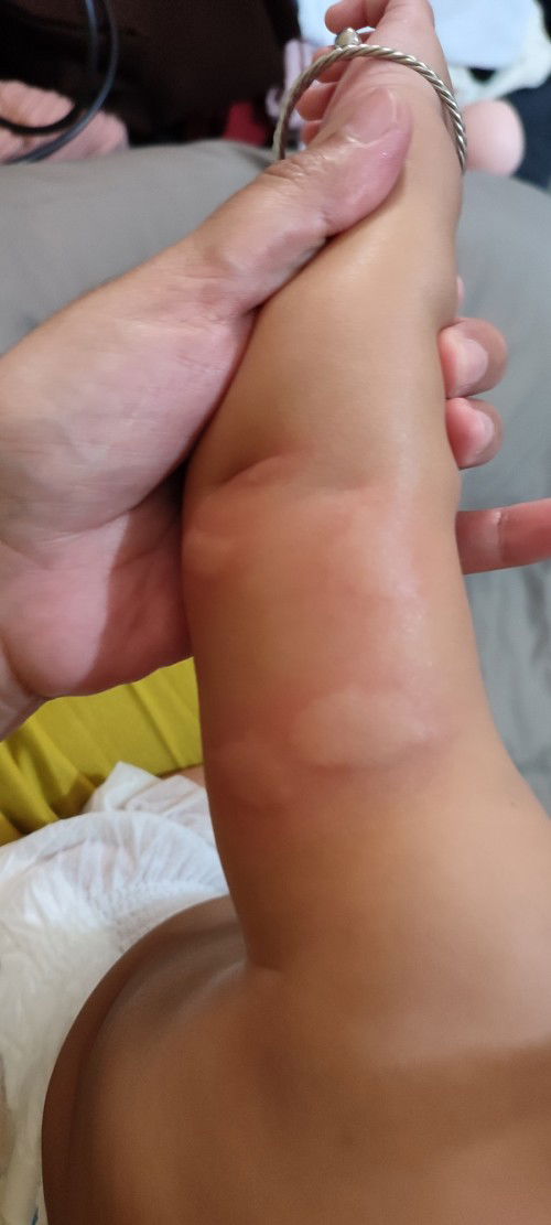 Kesel banget sama nyamuk