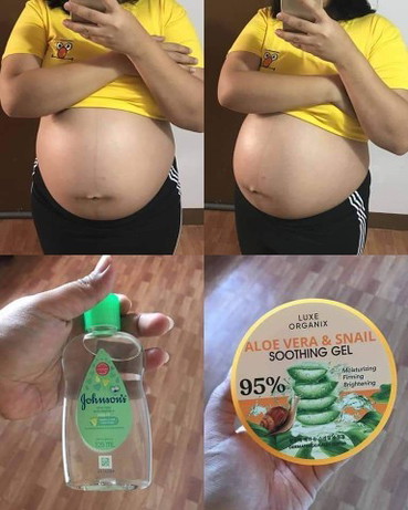 For Stretchmarks: Baby Oil & Aloe Vera