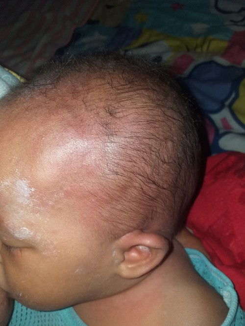 ตามภาพเลยค่ะ