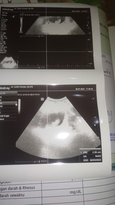 Mima percaya kamu masih hidup sayang