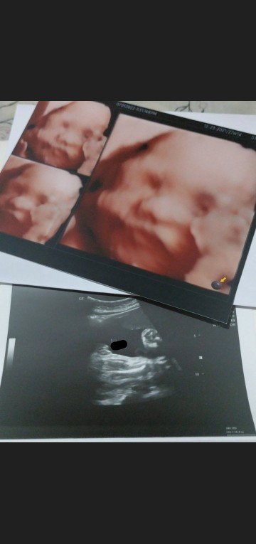 Gender Reveal
