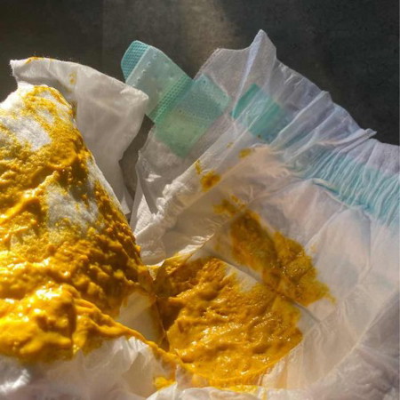 อึแบบนี้ปกติมัยคะ