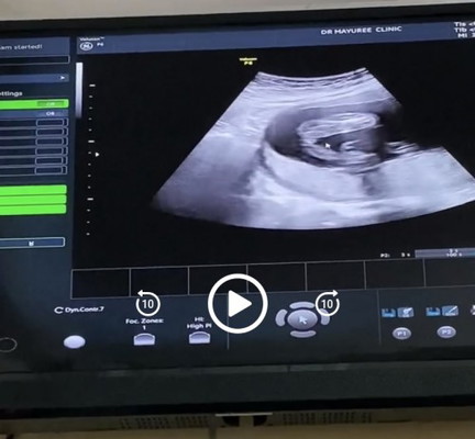 19วีคคะ ลูกชายหรือลูกสาวนะคะ