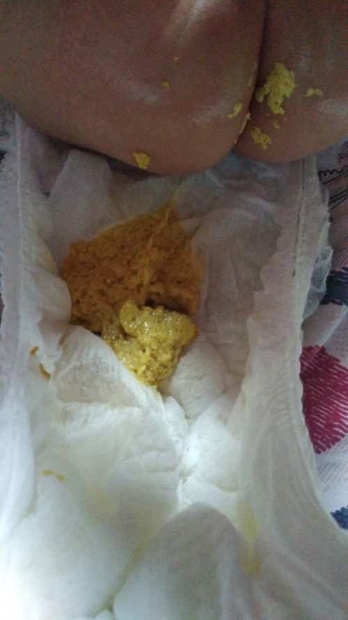 apakah normal pup bayi