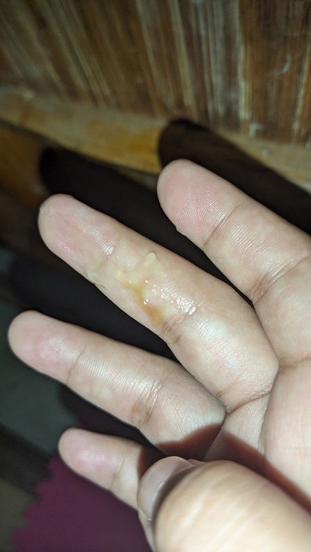 Manganganak na po ba kapag nilabasan ng ganito ?