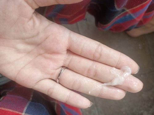 แบบนี้เรียกมูกหรือเปล่าแล้วเป็นอะไรมั้ย