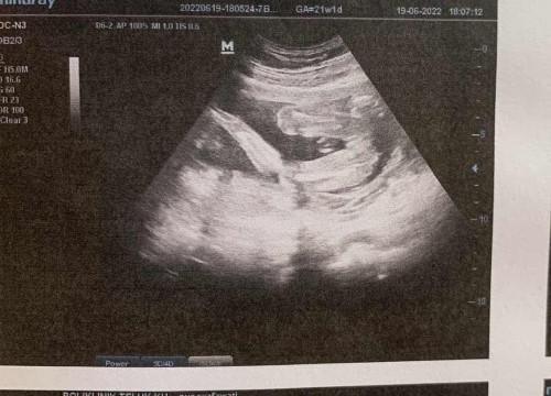 Girl or boy ?