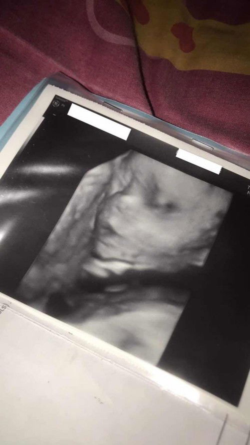 แม่ๆคนไหนตั้งชื่อน้องแล้วบ้าง น้องเพศชายค้าบ