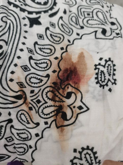 spoting and 1 cm @28weeks