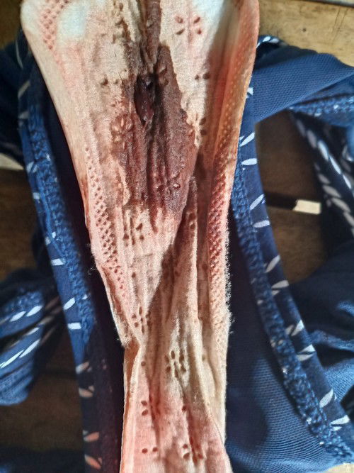 Paano malaman kung nakaopen na ang cervix?