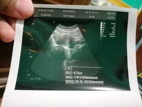 Keluar gumpalan darah