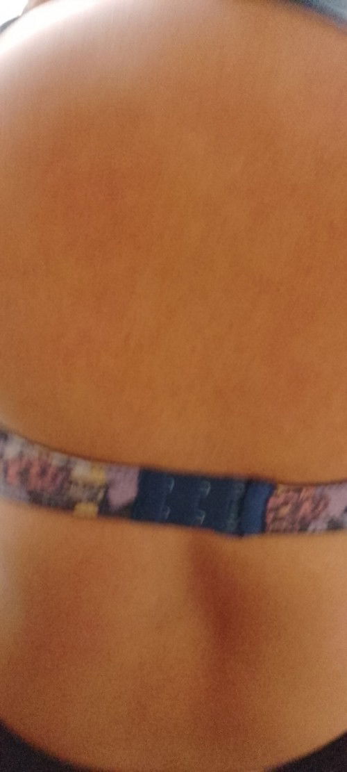 Allergy ka ba sa prenatal vitamins?