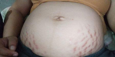 ขอคำแนะนำหน่อยค่ะ