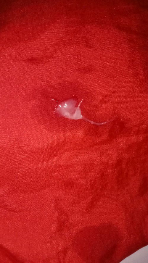 Pagi bund mau nanya kenapa yah kalo pagi suka keluar keputihan terus kental"gitu saya hamil Wek 19