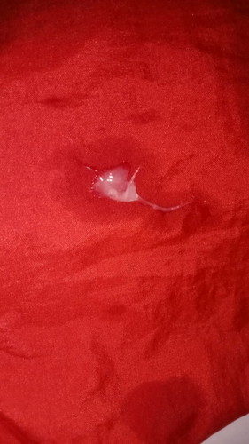 Pagi bund mau nanya kenapa yah kalo pagi suka keluar keputihan terus kental"gitu saya hamil Wek 19