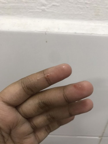 Spotting 6w 1d