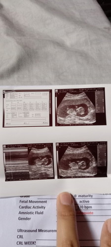 Boy or girl