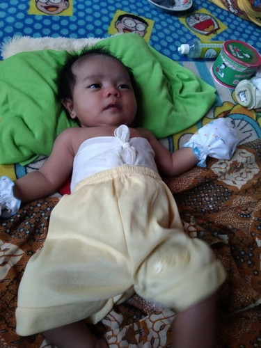 Bayi pakai gurita