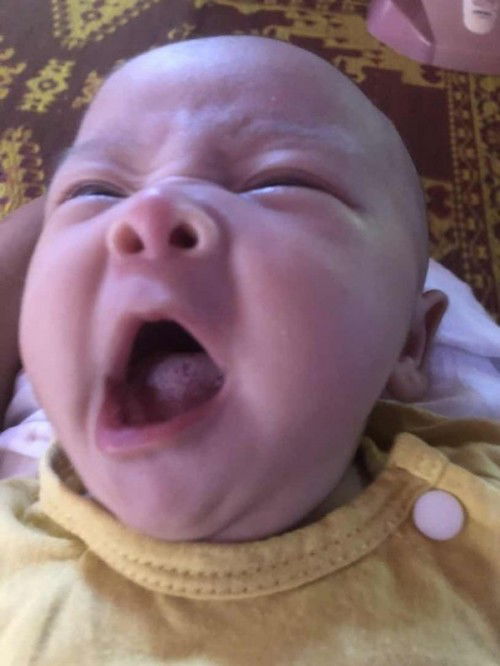 ลิ้นเป็นฝ้าหนาแบบนี้ปกติมั้ยคะกลัวเป็นเชื้อราค่ะ