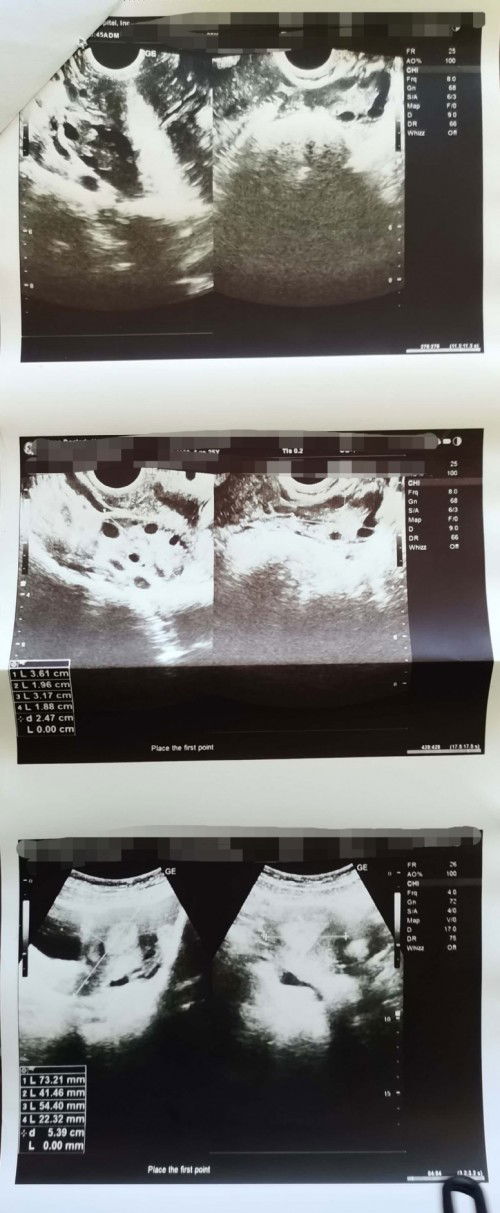 TO ALL PCOS MOMS/ 1ST TIME MOMS PAKI SHARE NMAN NG MGA ALAM. NYO. SALAMAT🙏✨🤍