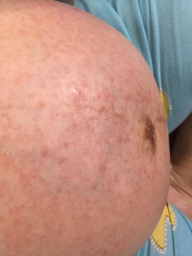 ผืนขึ้นหนักมากมีคัยเป็นเหมือนกันมาก