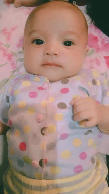 Mata anak belekan trus