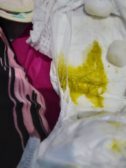 Bayi diare atau tidak