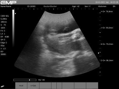 ขึ้นแบบนี้หญิงหรือชายค่ะแม่ๆ