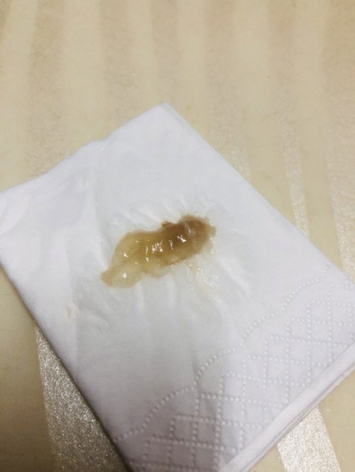 Hi mmy nak tanya mcmni tanda lendir darah ke