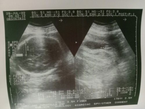 Confirm baby girl na ba ?