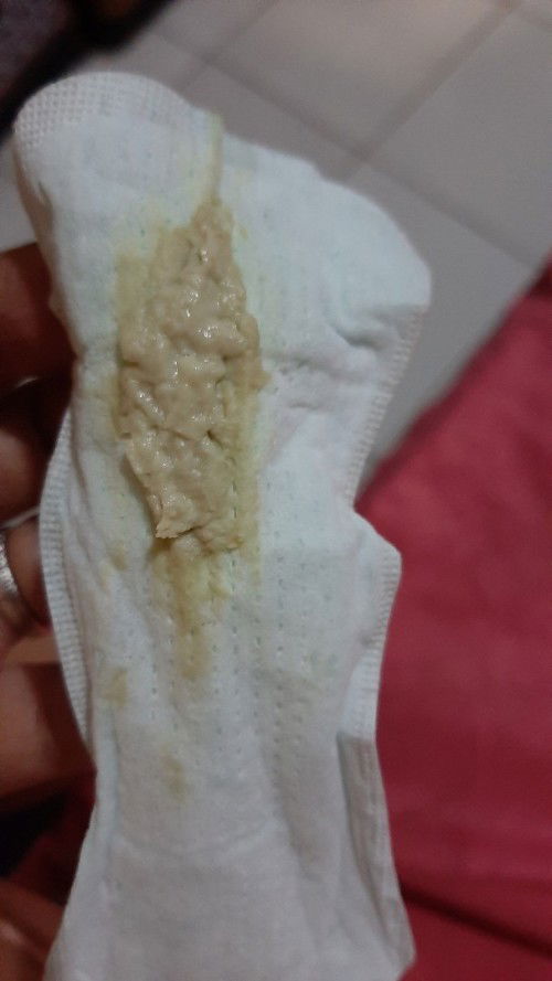 Keputihan saat hamil