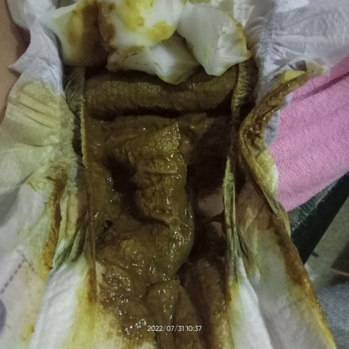 Yung tae po ng bby Ko parang meju Basa Po , Mix po sya... 4days Old Po..