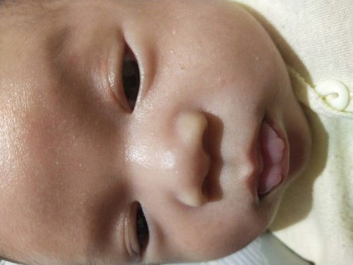 bibir bayi satu bulan