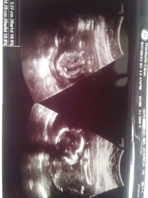 mga miii di pa po ba makita gender ni baby?