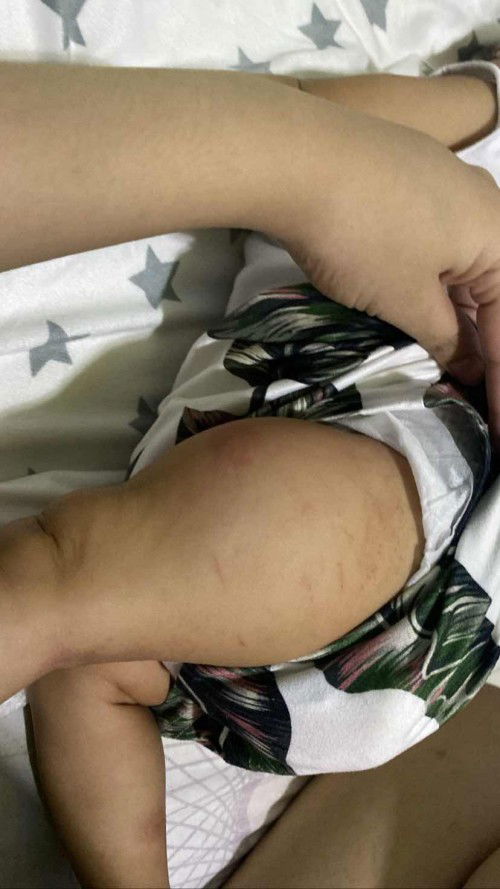 Asking for help/suggestions/recommendations