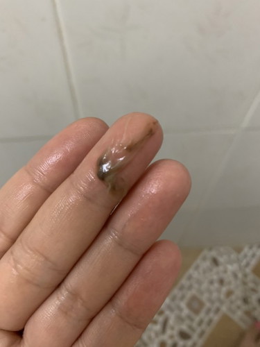 มีเมือกสีน้ำตาลออกมาแบบนี้คืออะไรคะ 7 สัปดาห์ 3 วันแล้วค่ะ