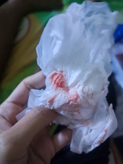 Flek di usia 21 week