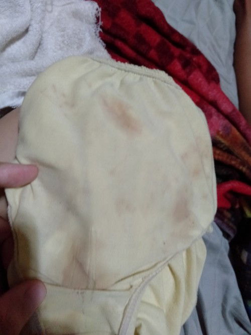 nag spotting po ako. 😔😟