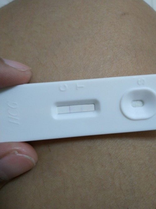 Urination and cramps