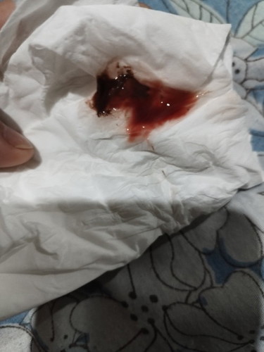 Mga mamshie tanong lang po due to implantation bleeding pa din po ba ito? 1 month preggy po ako now.