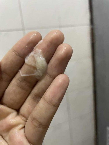 36+4 เป็นแบบนี้ต้องหาหมอมั้ยคะ