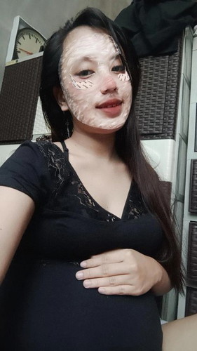 Normal panh ba sa 6 mos