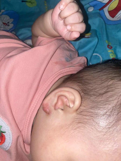 #tai_ngoài
#tai_ra_nước