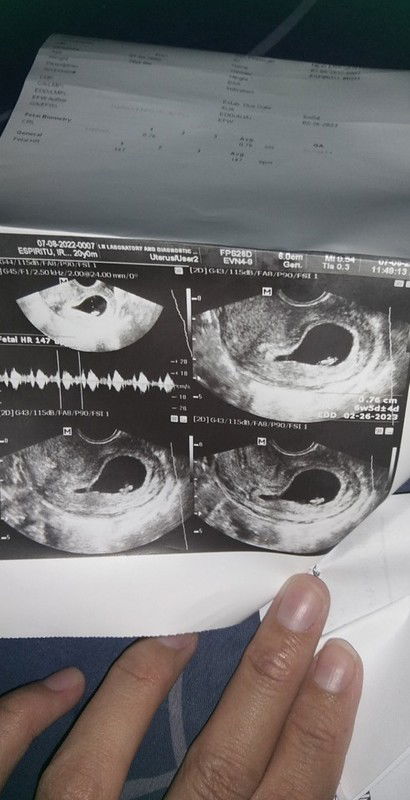 Hello po mga team februaryy #10weeks pregnant na po ako ngayon. Finally nasa loob na sya ng matress