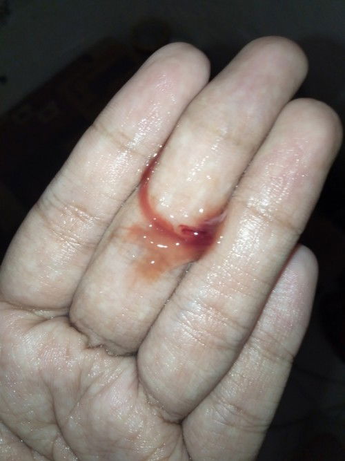 apa harus segera ke rs?